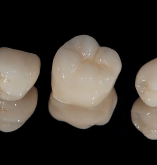 three dental crowns against a black background